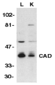 DFFB Antibody - Western blot of CAD in murine lung (L) and kidney (K) tissue lysates with CAD antibody at 1:500 dilution.