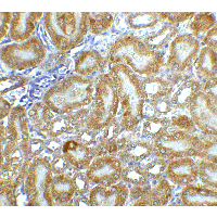 DFFB Antibody - Immunohistochemistry of CAD in mouse kidney tissue with CAD antibody at 5 µg/ml.