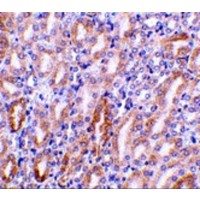 DFFB Antibody - Immunohistochemistry of CAD in mouse kidney tissue with CAD antibody at 1 µg/mL.