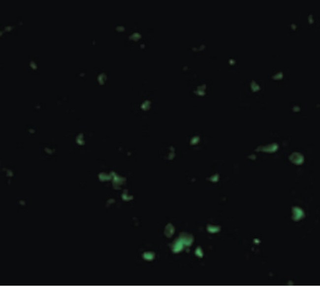 DFFB Antibody - Immunofluorescence of DFF40 in Jurkat cells with DFF40 antibody at 20 ug/ml.