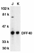 DFFB Antibody - Western blot of DFF40 in Jurkat (J) and K562 (K) whole cell lysate with anti-DFF40 at 1:500 dilution.