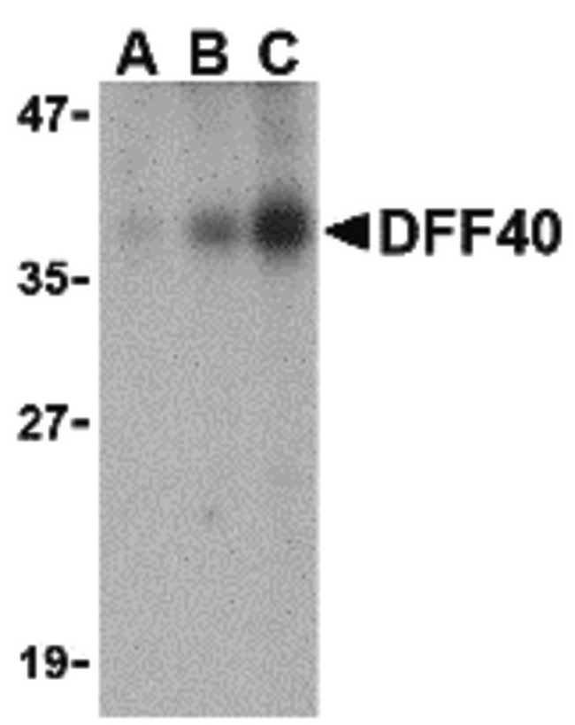 DFFB Antibody - Western blot of DFF40 in Jurkat cell lysate with DFF40 antibody at (A) 0.5, (B) 1 and (C) 2 ug/ml.