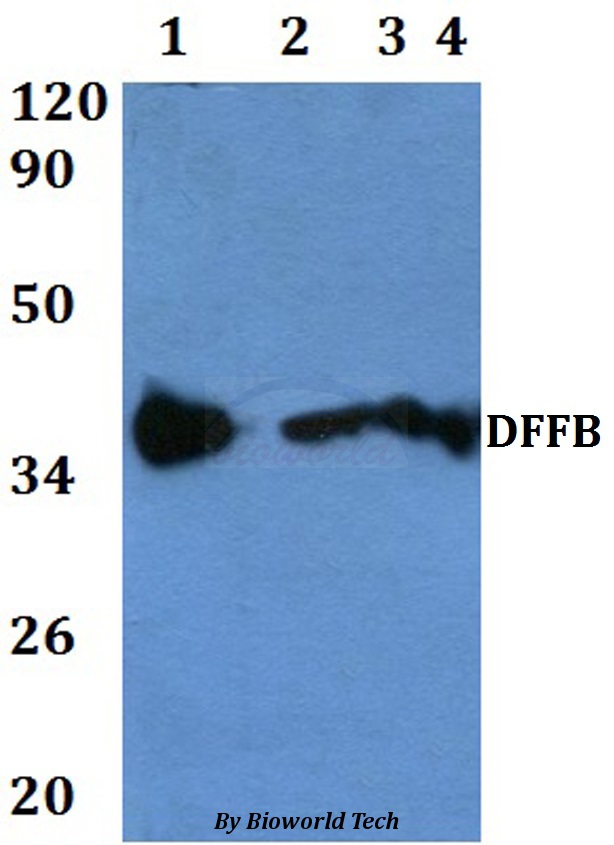 DFFB Antibody - Western blot of DFFB antibody at 1:500 dilution. Lane 1: HEK293T whole cell lysate. Lane 2: MCF-7 whole cell lysate. Lane 3: H9C2 whole cell lysate. Lane 4: Raw264.7 whole cell lysate.