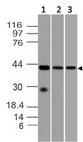 DFFB Antibody - Fig-1: Western blot analysis of DFF-40. Anti-DFF-40 antibody was used at 1 µg/ml on (1) h Spleen, (2) h Brain and (3) Ramos lysates.