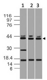 DFFB Antibody - Fig-2: Western blot analysis of DFF-40. Anti-DFF-40 antibody was used at 0.5 µg/ml on (1) EL-4, (2) 3T3 and (3) RAW lysates.