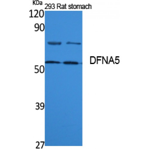 DFNA5 Antibody - Western blot of DFNA5 antibody