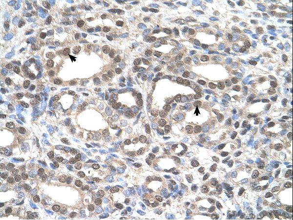 DFNA5 Antibody - DFNA5 antibody DFNA5(deafness, autosomal dominant 5) Antibody was used in IHC to stain formalin-fixed, paraffin-embedded human kidney.  This image was taken for the unconjugated form of this product. Other forms have not been tested.