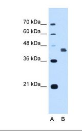 DFNA5 Antibody - Lane A: Marker. Lane B: HepG2 cell lysate. Antibody concentration: 1.25 ug/ml. Gel concentration: 12%.  This image was taken for the unconjugated form of this product. Other forms have not been tested.