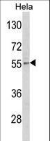 DFNA5 Antibody - Western blot of DFNA5 Antibody in HeLa cell line lysates (35 ug/lane). DFNA5 (arrow) was detected using the purified antibody.