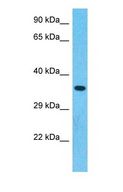 DFNA5 Antibody - Western blot of DFNA5 Antibody with human 293T Whole Cell lysate.  This image was taken for the unconjugated form of this product. Other forms have not been tested.