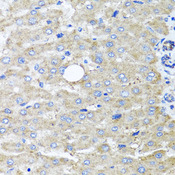 DFNA5 Antibody - Immunohistochemistry of paraffin-embedded human liver injury tissue.