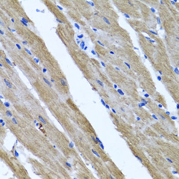 DFNA5 Antibody - Immunohistochemistry of paraffin-embedded rat heart.