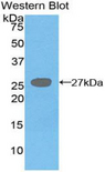 DGAT1 Antibody - Western blot of recombinant DGAT1 / DGAT.  This image was taken for the unconjugated form of this product. Other forms have not been tested.