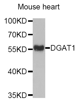 DGAT1 Antibody - Western blot analysis of extracts of Mouse heart tissue, using DGAT1 antibody.