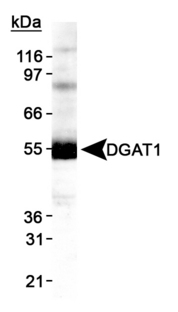 DGAT1 Antibody - Detection of DGAT1 in HepG2 lysate.  This image was taken for the unconjugated form of this product. Other forms have not been tested.