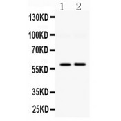 DGAT1 Antibody - DGAT1 antibody Western blot. All lanes: Anti DGAT1 at 0.5 ug/ml. Lane 1: Rat Kidney Tissue Lysate at 50 ug. Lane 2: HELA Whole Cell Lysate at 40 ug. Predicted band size: 60 kD. Observed band size: 60 kD.