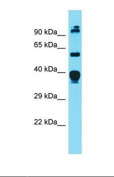 DGAT1 Antibody - Western blot of Mouse Heart. Dgat1 antibody dilution 1.0 ug/ml.  This image was taken for the unconjugated form of this product. Other forms have not been tested.