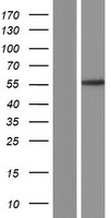 DGAT1 Protein - Western validation with an anti-DDK antibody * L: Control HEK293 lysate R: Over-expression lysate