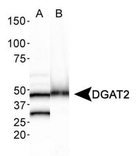 DGAT2 Antibody - Western Blot: DGAT2 Antibody - Analysis of DGAT2 in A. human liver lysate and B. mouse brain lysate.  This image was taken for the unconjugated form of this product. Other forms have not been tested.