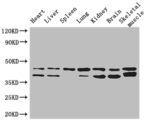 DGAT2 Antibody - Positive WB detected in:Mouse heart tissue,Mouse liver tissue,Mouse spleen tissue,Mouse lung tissue,Mouse kidney tissue,Mouse brain tissue,Mouse skeletal muscle tissue;All lanes: DGAT2 antibody at 3ug/ml;Secondary;Goat polyclonal to rabbit IgG at 1/50000 dilution;Predicted band size: 44,40 kDa;Observed band size: 44,40 kDa;