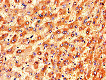 DGAT2 Antibody - Immunohistochemistry of paraffin-embedded human liver tissue using DGAT2 Antibody at dilution of 1:100