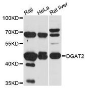 DGAT2 Antibody - Western blot analysis of extracts of various cell lines, using DGAT2 antibody at 1:3000 dilution. The secondary antibody used was an HRP Goat Anti-Rabbit IgG (H+L) at 1:10000 dilution. Lysates were loaded 25ug per lane and 3% nonfat dry milk in TBST was used for blocking. An ECL Kit was used for detection and the exposure time was 90s.