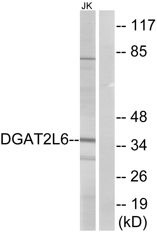 DGAT2L6 Antibody - Western blot analysis of lysates from Jurkat cells, using DGAT2L6 Antibody. The lane on the right is blocked with the synthesized peptide.