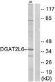 DGAT2L6 Antibody - Western blot analysis of extracts from Jurkat cells, using DGAT2L6 antibody.