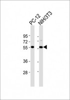 DGCR14 Antibody - All lanes : Anti-DGCR14 Antibody at 1:2000 dilution Lane 1: PC-12 whole cell lysates Lane 2: NIH/3T3 whole cell lysates Lysates/proteins at 20 ug per lane. Secondary Goat Anti-Rabbit IgG, (H+L), Peroxidase conjugated at 1/10000 dilution Predicted band size : 53 kDa Blocking/Dilution buffer: 5% NFDM/TBST.