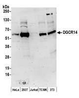 DGCR14 Antibody - Detection of human and mouse DGCR14 by western blot. Samples: Whole cell lysate (50 µg) from HeLa, HEK293T, Jurkat, mouse TCMK-1, and mouse NIH 3T3 cells prepared using NETN lysis buffer. Antibodies: Affinity purified rabbit anti-DGCR14 antibody used for WB at 1 µg/ml. Detection: Chemiluminescence with an exposure time of 3 minutes.