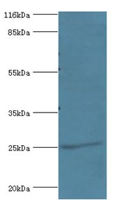 DGCR6L Antibody - Western blot. All lanes: Protein DGCR6L antibody at 2 ug/ml+mouse brain tissue. Secondary antibody: Goat polyclonal to rabbit at 1:10000 dilution. Predicted band size: 25 kDa. Observed band size: 25 kDa.  This image was taken for the unconjugated form of this product. Other forms have not been tested.