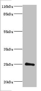 DGCR6L Antibody - Western blot All lanes: Protein DGCR6L antibody at 2µg/ml + Mouse brain tissue Secondary Goat polyclonal to rabbit IgG at 1/10000 dilution Predicted band size: 25 kDa Observed band size: 25 kDa