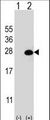 DGCR6L Antibody - Western blot of DGCR6L (arrow) using rabbit polyclonal DGCR6L Antibody. 293 cell lysates (2 ug/lane) either nontransfected (Lane 1) or transiently transfected (Lane 2) with the DGCR6L gene.