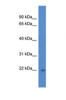 DGCR6L Antibody - DGCR6L antibody Western blot of Fetal Brain lysate. Antibody concentration 1 ug/ml.  This image was taken for the unconjugated form of this product. Other forms have not been tested.