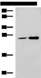 DGCR6L Antibody - Western blot analysis of 293T cell lysates  using DGCR6L Polyclonal Antibody at dilution of 1:800