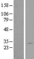 DGCR6L Protein - Western validation with an anti-DDK antibody * L: Control HEK293 lysate R: Over-expression lysate