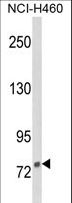 DGCR8 Antibody - Western blot of DGCR8 Antibody in NCI-H460 cell line lysates (35 ug/lane). DGCR8 (arrow) was detected using the purified antibody.