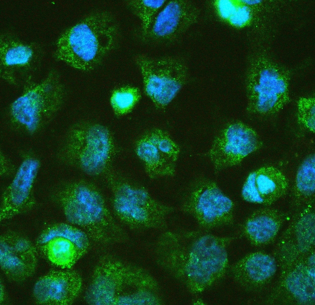DGCR8 Antibody - IF analysis of DGCR8 using anti-DGCR8 antibody DGCR8 was detected in immunocytochemical section of A431 cell. Enzyme antigen retrieval was performed using IHC enzyme antigen retrieval reagent for 15 mins. The tissue section was blocked with 10% goat serum. The tissue section was then incubated with 2µg/mL rabbit anti-DGCR8 Antibody overnight at 4°C. DyLight®488 Conjugated Goat Anti-Rabbit IgG was used as secondary antibody at 1:100 dilution and incubated for 30 minutes at 37°C. The section was counterstained with DAPI. Visualize using a fluorescence microscope and filter sets appropriate for the label used.