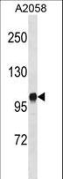 DGK-IOTA / DGKI Antibody - DGKI Antibody (Y905) western blot of A2058 cell line lysates (35 ug/lane). The DGKI antibody detected the DGKI protein (arrow).