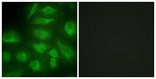 DGK-IOTA / DGKI Antibody - Immunofluorescence analysis of HeLa cells, using DGKI Antibody. The picture on the right is blocked with the synthesized peptide.