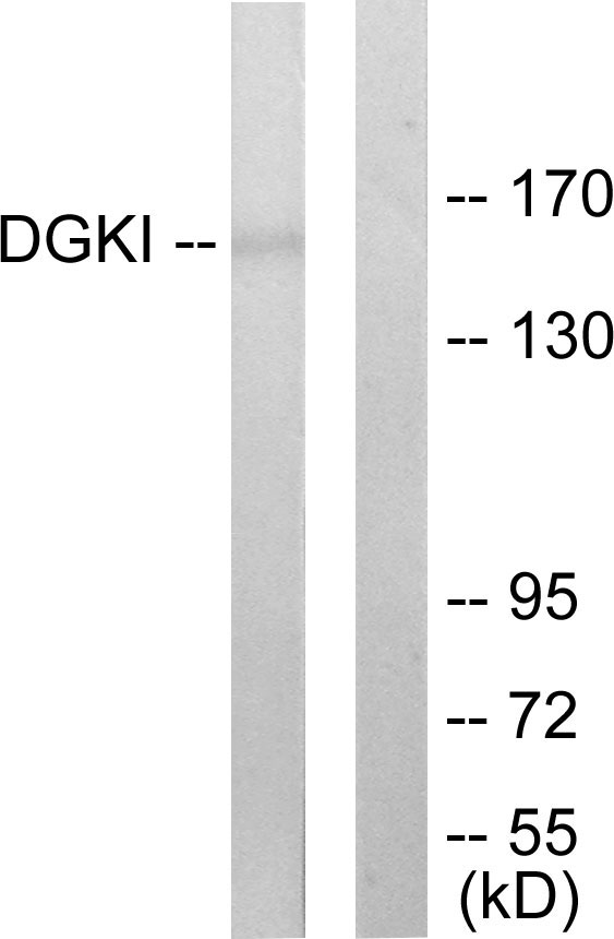 DGK-IOTA / DGKI Antibody - Western blot analysis of lysates from 293 cells, using DGKI Antibody. The lane on the right is blocked with the synthesized peptide.