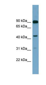 DGKA Antibody - DGKA antibody Western blot of Fetal Heart lysate. This image was taken for the unconjugated form of this product. Other forms have not been tested.
