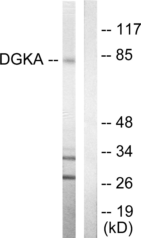 DGKA Antibody - Western blot analysis of lysates from Jurkat cells, using DGKA Antibody. The lane on the right is blocked with the synthesized peptide.