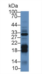 DGKA Antibody - Western Blot; Sample: Mouse Liver lysate; Primary Ab: 2µg/mL Rabbit Anti-Mouse DGKa Antibody Second Ab: 0.2µg/mL HRP-Linked Caprine Anti-Rabbit IgG Polyclonal Antibody