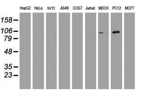 DGKA Antibody - Western blot of extracts (35ug) from 9 different cell lines by using anti-DGKA monoclonal antibody.