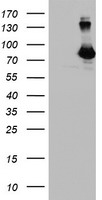DGKA Antibody - HEK293T cells were transfected with the pCMV6-ENTRY control (Left lane) or pCMV6-ENTRY DGKA (Right lane) cDNA for 48 hrs and lysed. Equivalent amounts of cell lysates (5 ug per lane) were separated by SDS-PAGE and immunoblotted with anti-DGKA.