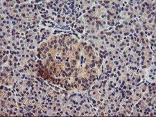 DGKA Antibody - IHC of paraffin-embedded Human pancreas tissue using anti-DGKA mouse monoclonal antibody.
