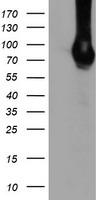 DGKA Antibody - HEK293T cells were transfected with the pCMV6-ENTRY control (Left lane) or pCMV6-ENTRY DGKA (Right lane) cDNA for 48 hrs and lysed. Equivalent amounts of cell lysates (5 ug per lane) were separated by SDS-PAGE and immunoblotted with anti-DGKA.