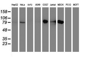 DGKA Antibody - Western blot of extracts (35 ug) from 9 different cell lines by using anti-DGKA monoclonal antibody.