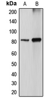 DGKA Antibody - Western blot analysis of DGK alpha expression in MDCK (A); COS7 (B) whole cell lysates.